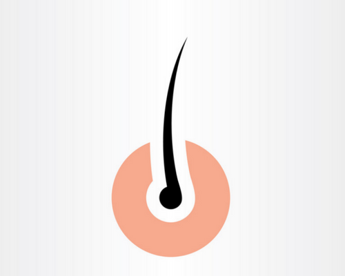 Hernia Doctor in Chennai