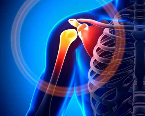 Hernia Doctor in Chennai